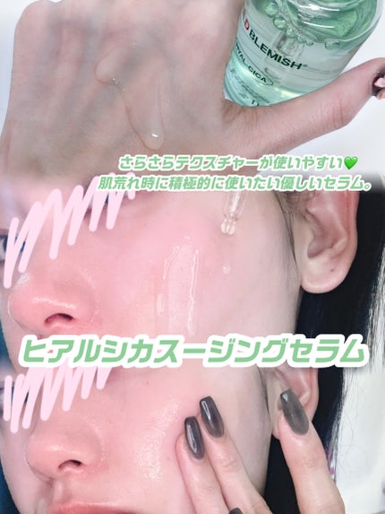 レッドブレミッシュ クリアスージングクリーム/Dr.G/フェイスクリームを使ったクチコミ(2枚目)