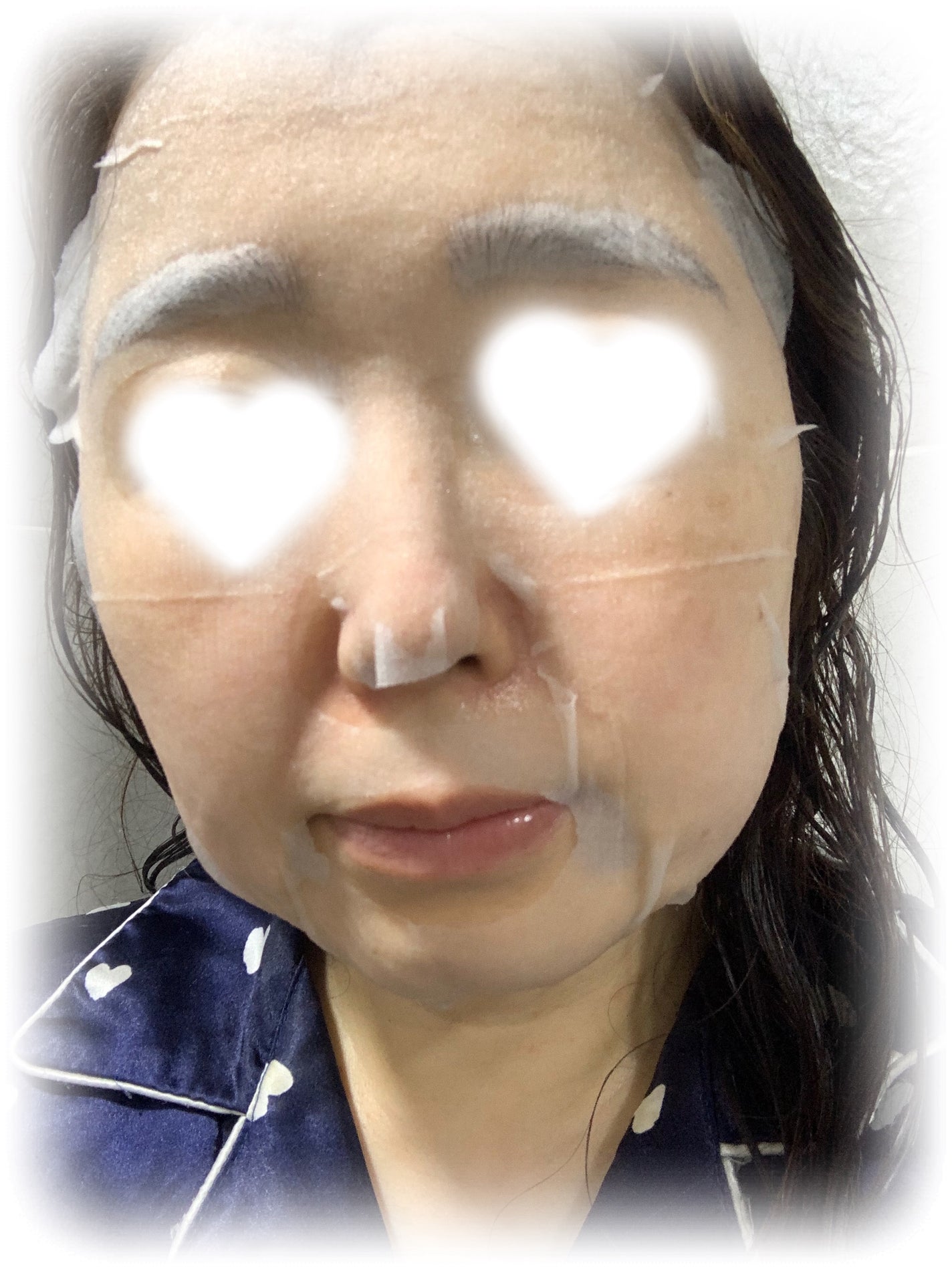 ドクダミシートマスクデイリーピック/Abib /シートマスク・パックを使ったクチコミ(3枚目)