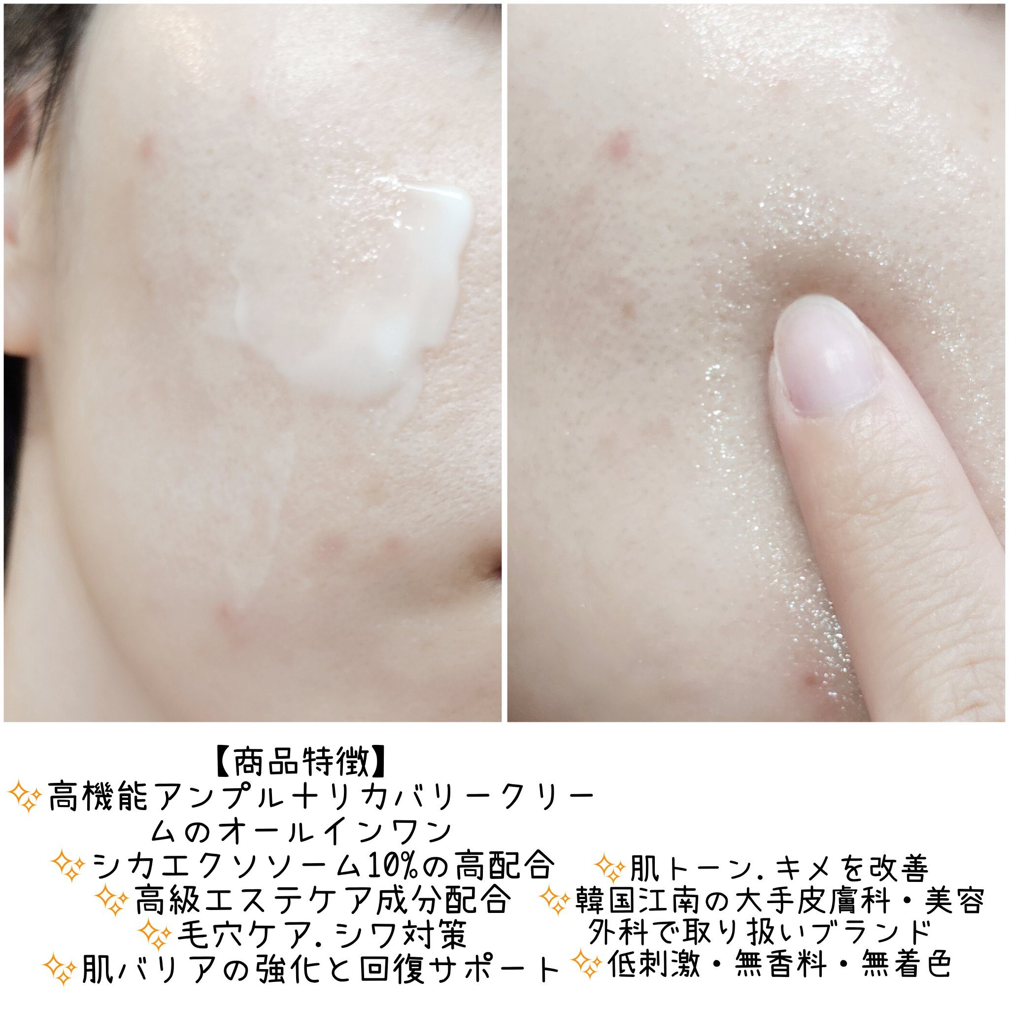 グッドナイト シカエクソソームリカバリーアンプルクリーム/12EST/フェイスクリームを使ったクチコミ（3枚目）