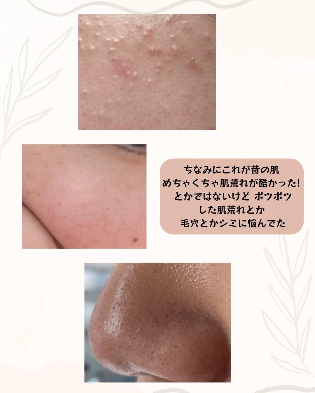 glowoverdose on LIPS 「おすすめのスキンケア紹介も/最近、肌の調子が良くなった秘密をシ..」(3枚目)