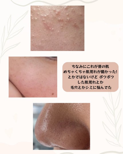 を使ったクチコミ(3枚目)