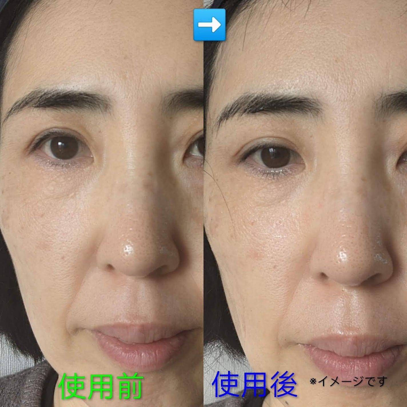 ツボクサスージングハイドロヨモギマスク/LIALUSTER/シートマスク・パックを使ったクチコミ(4枚目)