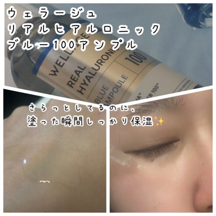 リアルヒアルロニックブルーアンプル 100/Wellage/美容液を使ったクチコミ(2枚目)