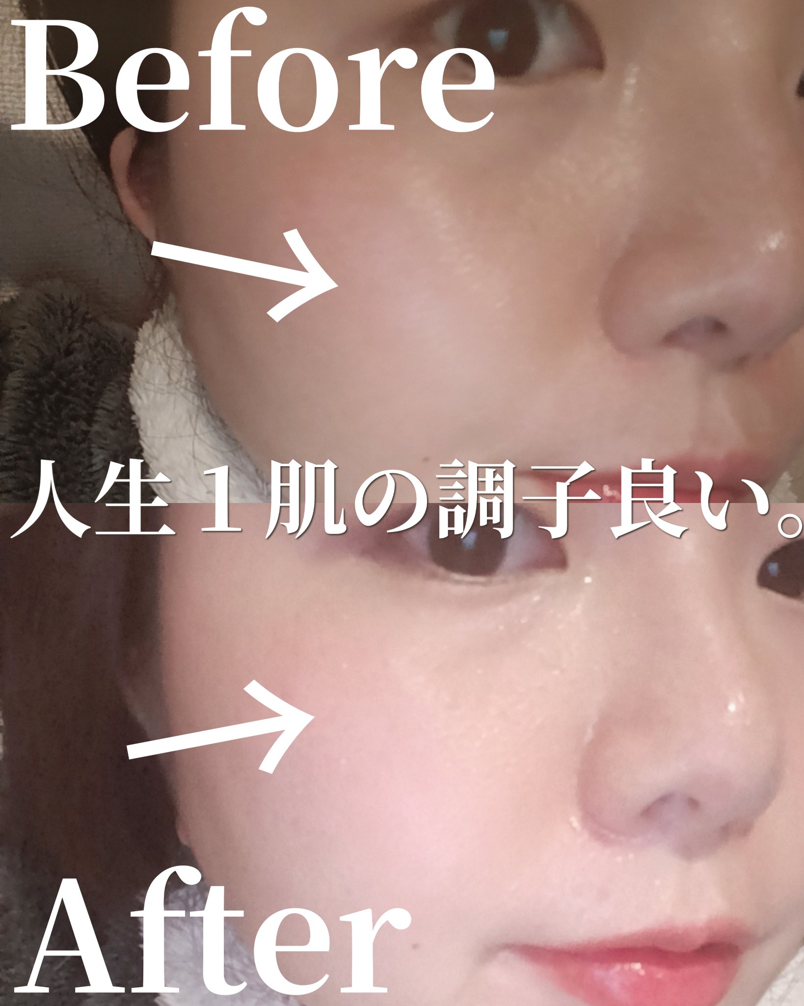 ミシャ ビタシープラス 薬用ブライトニング美容液/MISSHA/美容液を使ったクチコミ（1枚目）