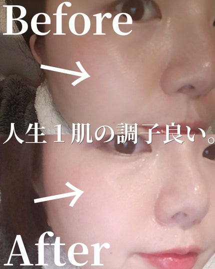 ミシャ ビタシープラス 薬用ブライトニング美容液/MISSHA/美容液を使ったクチコミ(1枚目)