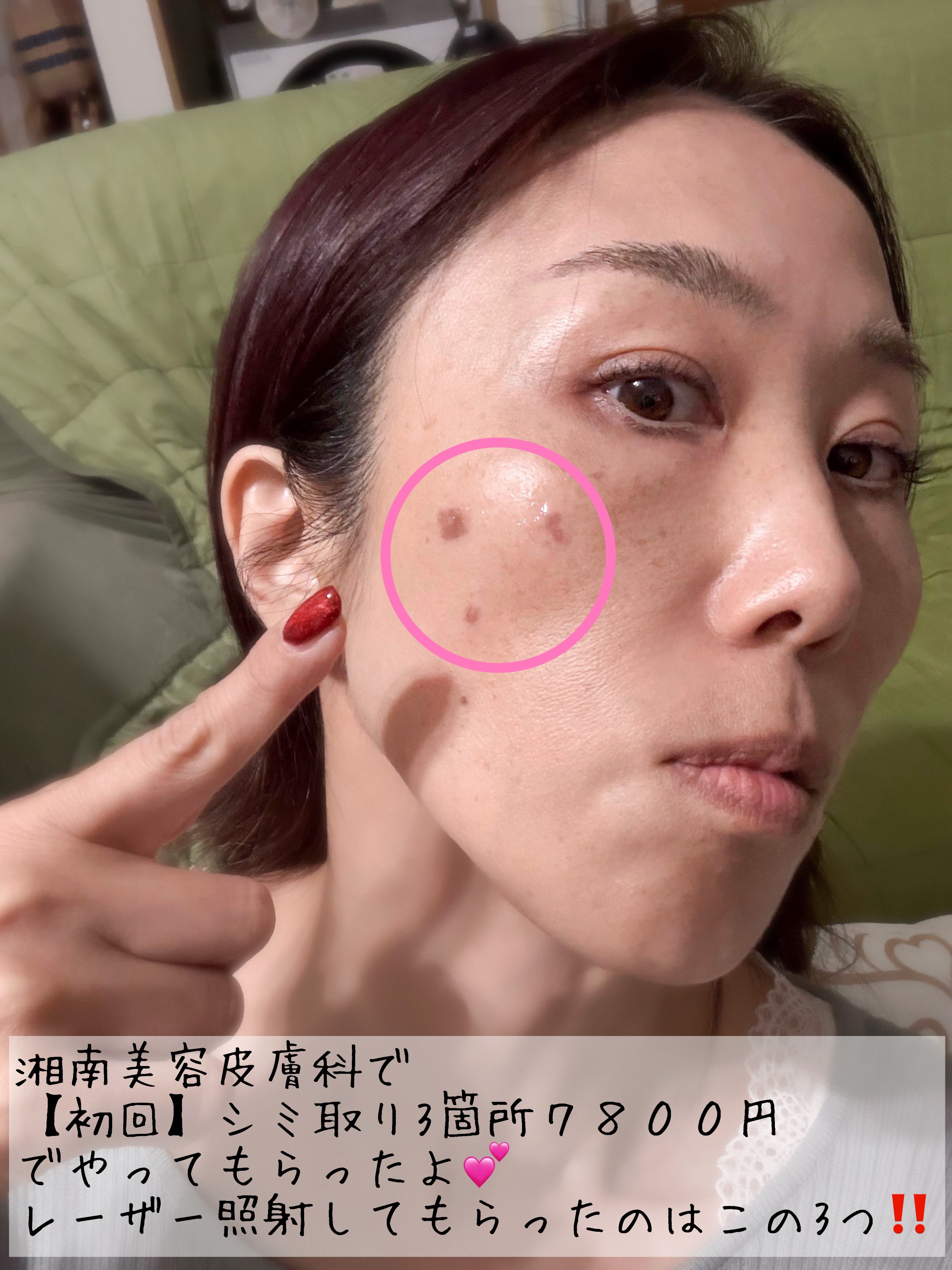 を使ったクチコミ（2枚目）