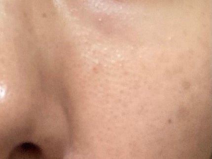 バランシングGAローション/TOUT VERT/化粧水を使ったクチコミ(3枚目)