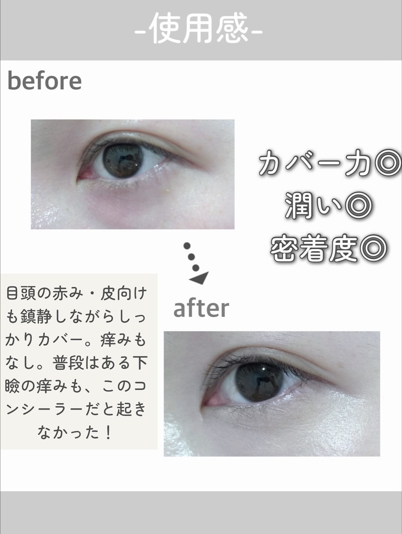 nao on LIPS 「23yearsoldさんの大人気商品【ダーマシンコンシーラー】..」(4枚目)