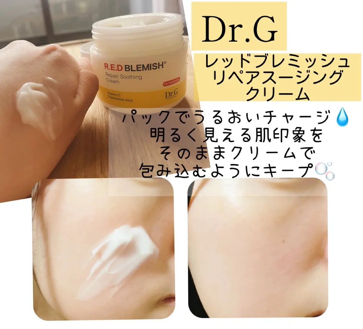 レッドブレミッシュ リペアスージングクリーム/Dr.G/フェイスクリームを使ったクチコミ（3枚目）