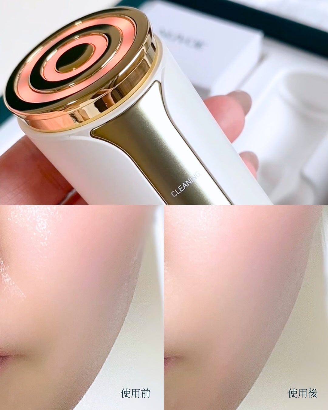 ヌボエ スペシャルセット/NUVOE/美顔器・マッサージを使ったクチコミ(5枚目)