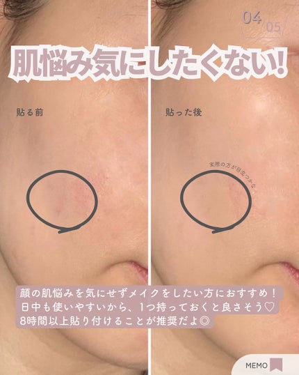 顔用パッチ/バンドエイド/その他スキンケアを使ったクチコミ(5枚目)