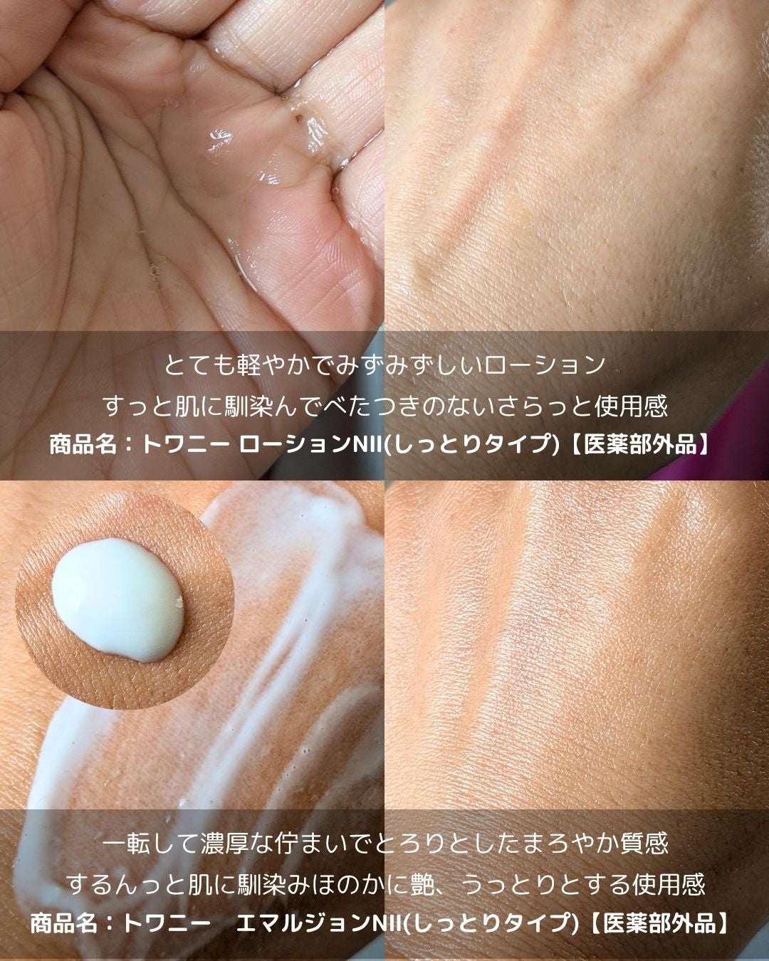 トワニー ローションN II/TWANY/化粧水を使ったクチコミ(2枚目)