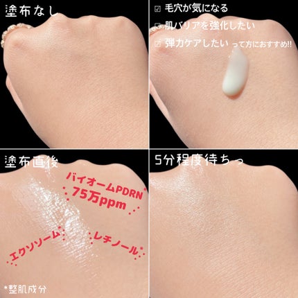 ReDRNエクソソームアンプル/Dr.nineteen/美容液を使ったクチコミ(5枚目)