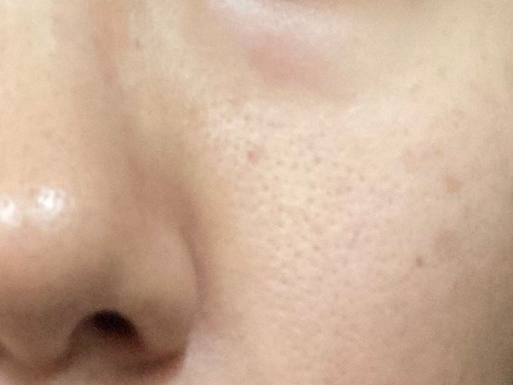 バランシングGAローション/TOUT VERT/化粧水を使ったクチコミ(1枚目)