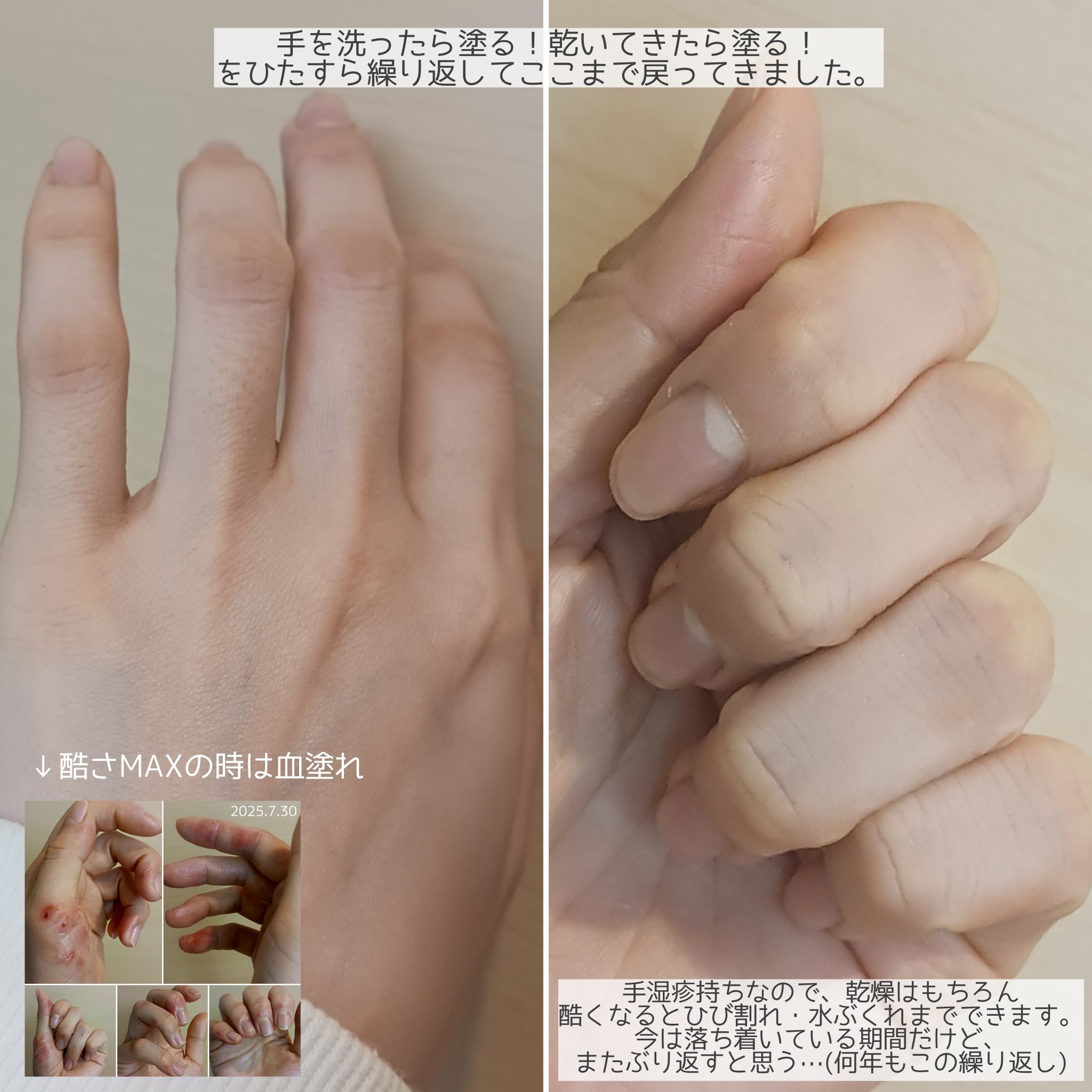 マツキヨ  セラミド化粧水/matsukiyo/化粧水を使ったクチコミ（3枚目）