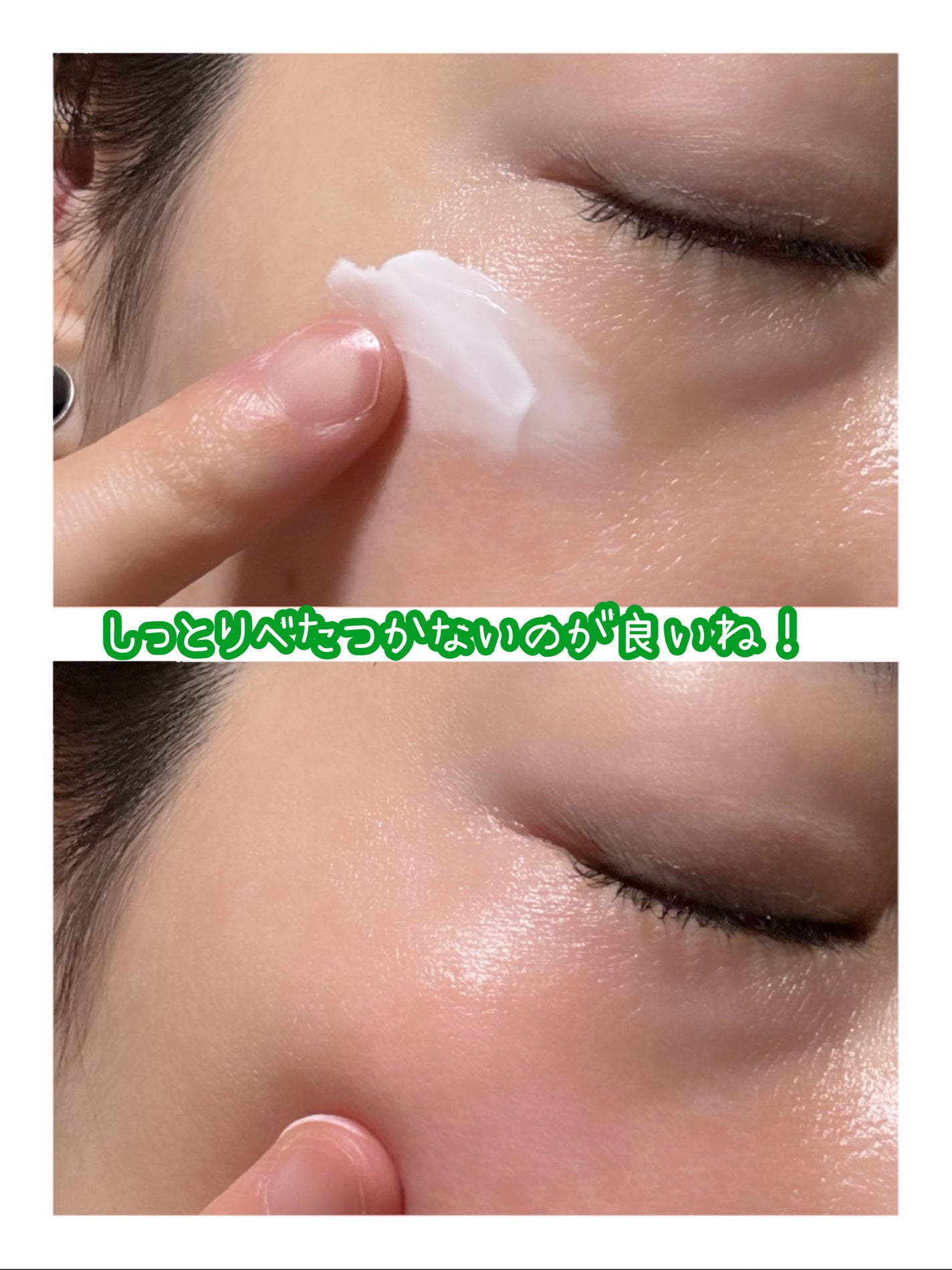 インテンシブクリーム/ZEROID/フェイスクリームを使ったクチコミ(4枚目)