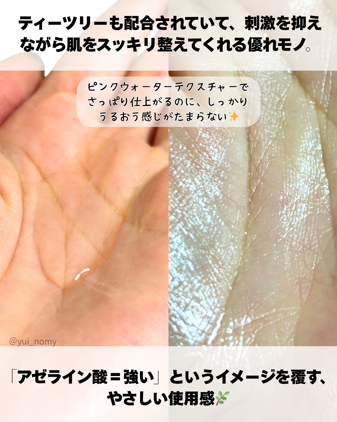 AZケア トナー/VT/化粧水を使ったクチコミ（3枚目）