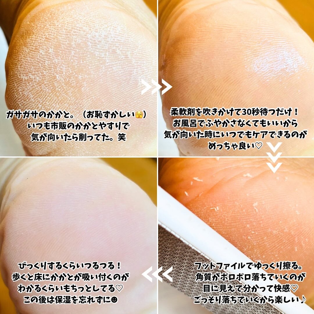 フットケアセット/BAREN/その他キットセットを使ったクチコミ(3枚目)