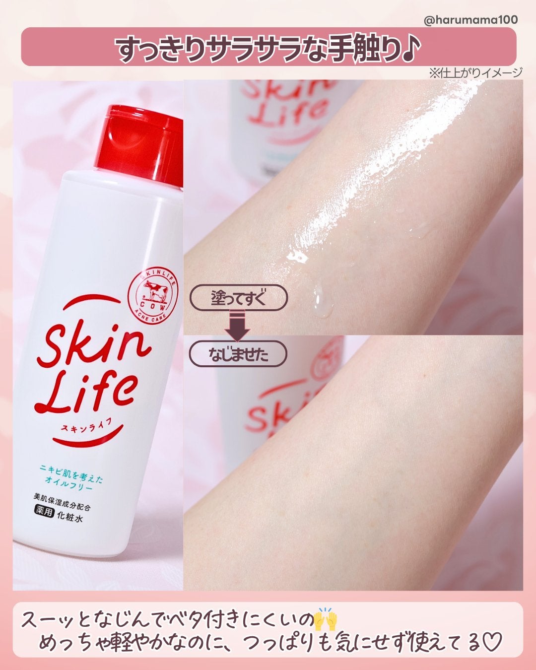 薬用化粧水/スキンライフ/化粧水を使ったクチコミ(4枚目)