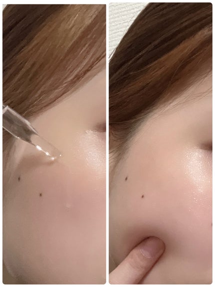 ミシャ ビタシープラス 薬用ブライトニング美容液/MISSHA/美容液を使ったクチコミ(4枚目)