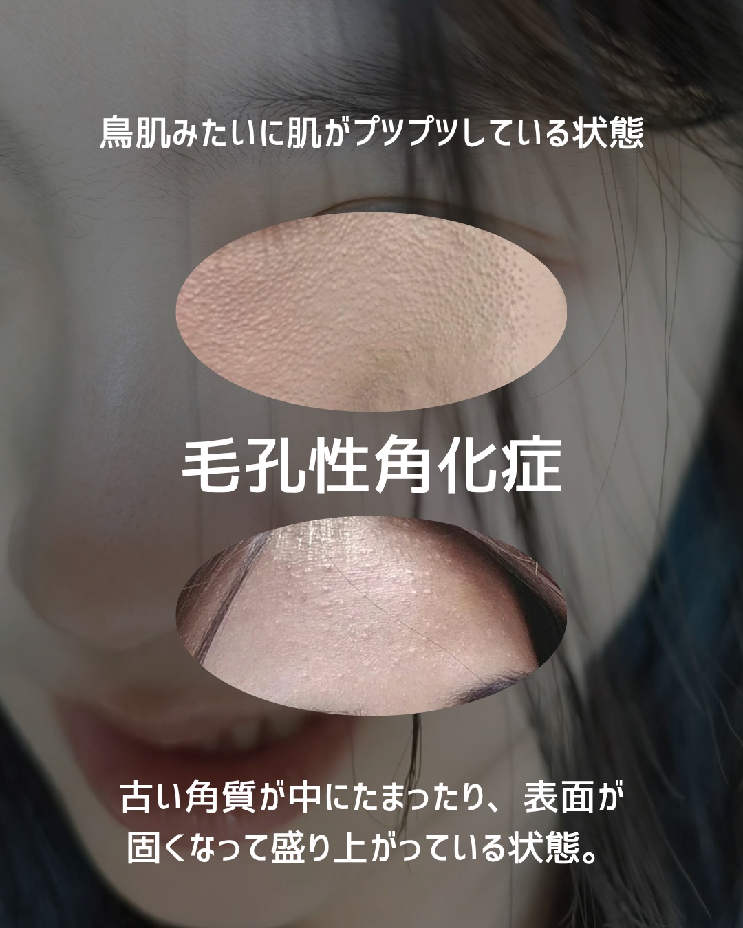 フェイスピーリングジェル ピーチの香り/DAISO/ピーリングを使ったクチコミ（2枚目）