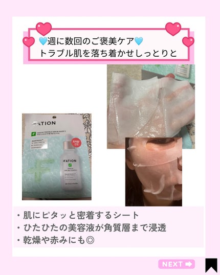 Kana on LIPS 「肌がゆらぎやすい季節の変わり目にこそ、“生シカ美容液×集中パッ..」(4枚目)