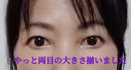 りそうのふたえ くっきりクセづけ/DAISO/二重まぶた用アイテムを使ったクチコミ(1枚目)