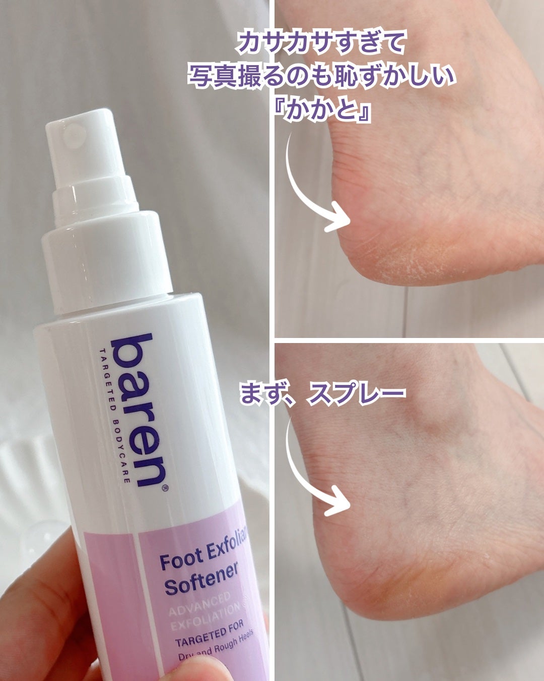 フットケアセット/BAREN/その他キットセットを使ったクチコミ(3枚目)