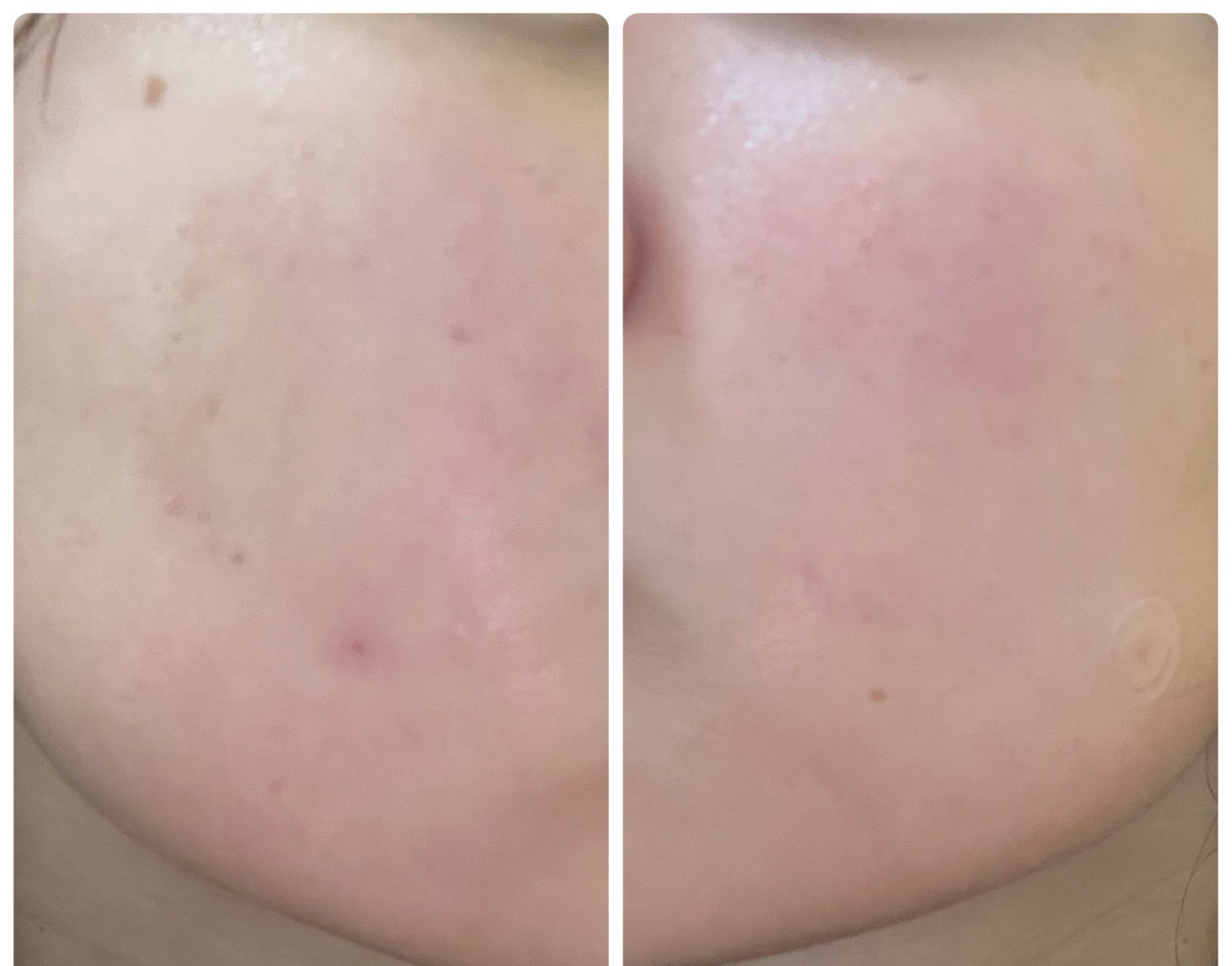 ぽむ on LIPS 「1枚目 2025.11.2エピデュオ 781日目2枚目 202..」(5枚目)