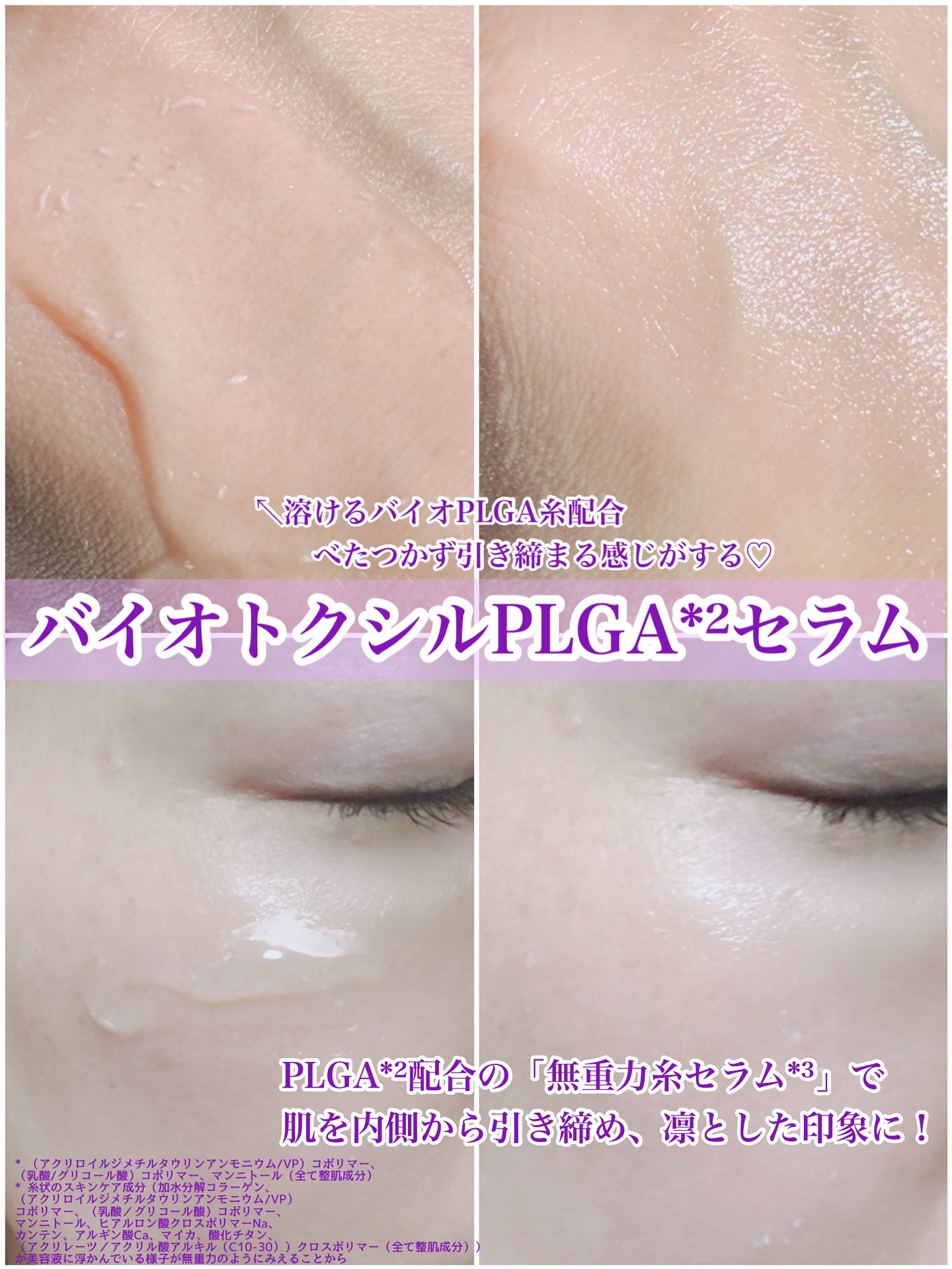 バイオヒールボ プロバイオダーム 3Dリフティングクリーム/BIOHEAL BOH/フェイスクリームを使ったクチコミ（3枚目）