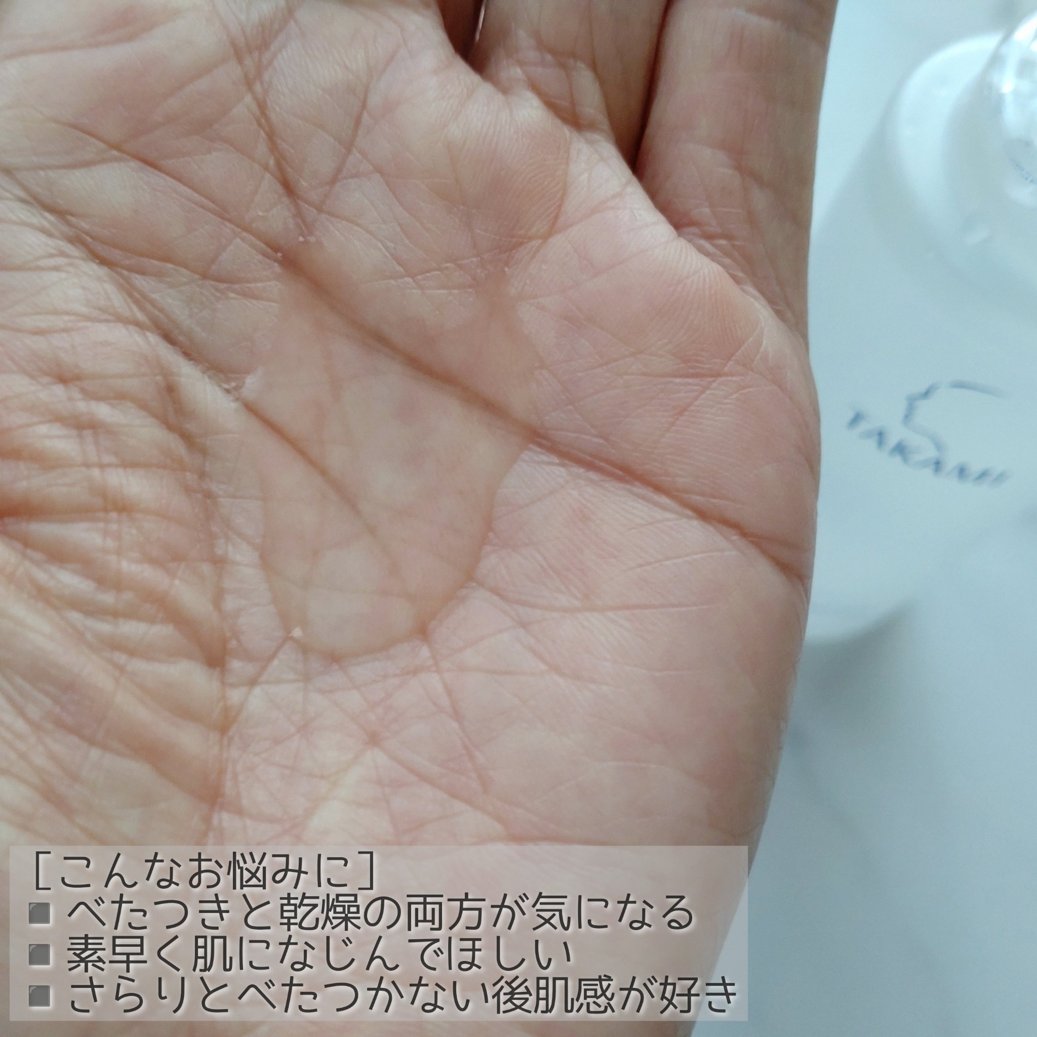 タカミローション Ⅰ/タカミ/化粧水を使ったクチコミ（2枚目）