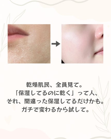 アネトス バランシング トリートメントクリーム/Anetos/フェイスクリームを使ったクチコミ(2枚目)