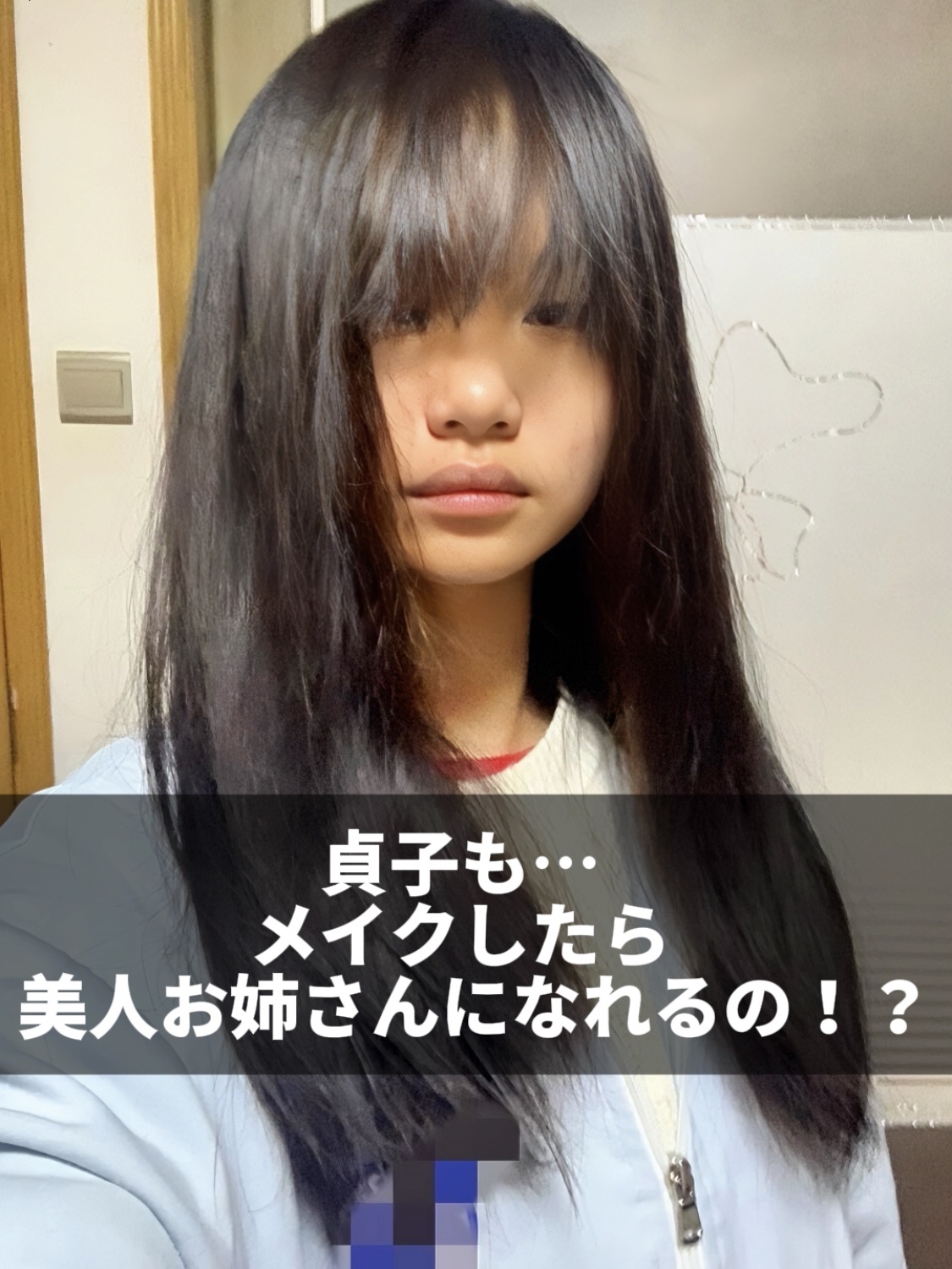 アネトス アクネケア トリートメント セラム/Anetos/美容液を使ったクチコミ（1枚目）