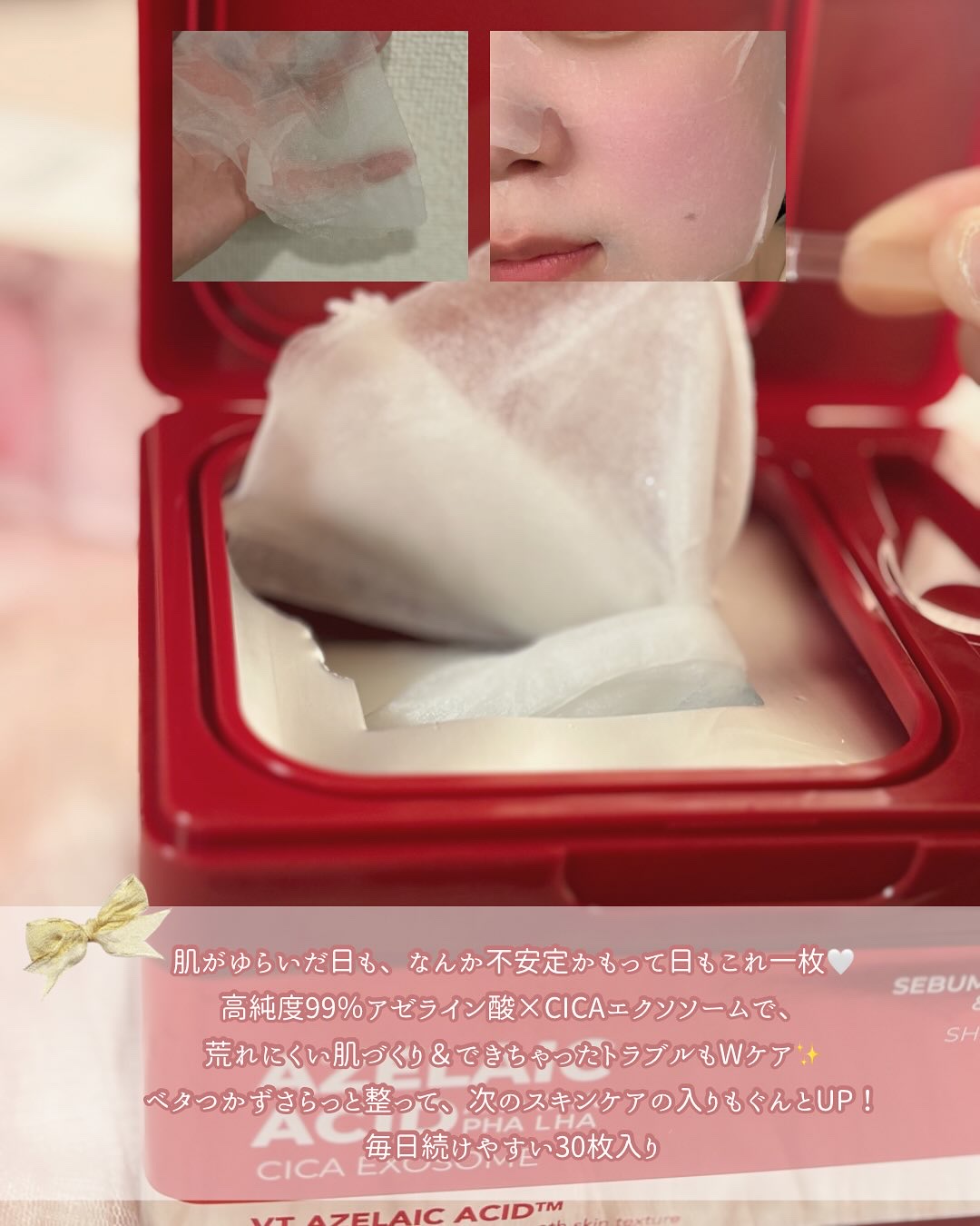 AZケア マスク/VT/シートマスク・パックを使ったクチコミ（3枚目）