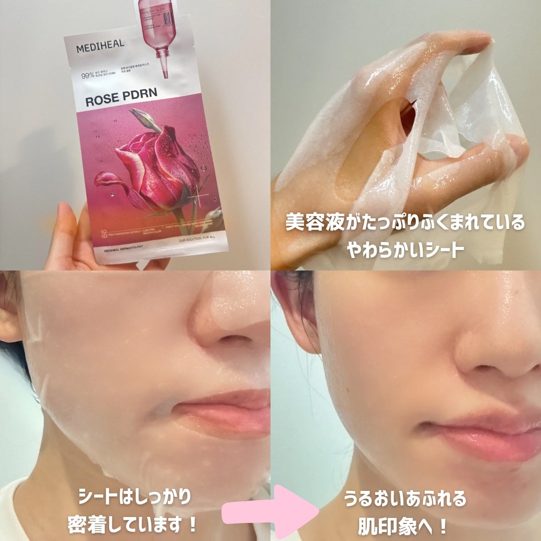 ローゼPDRNエッセンシャルマスクヘルシーグロウ/MEDIHEAL/シートマスク・パックを使ったクチコミ(3枚目)