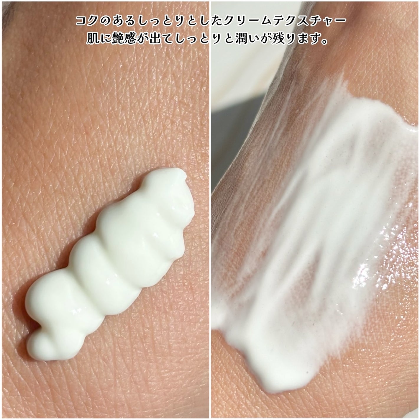 PDRN+リードルS 100/VT/美容液を使ったクチコミ(3枚目)