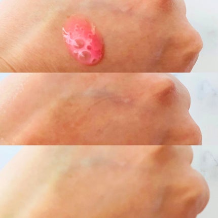 PDRNピンクアンプル PDRN 10,000ppm配合/MEDICUBE/美容液を使ったクチコミ(3枚目)