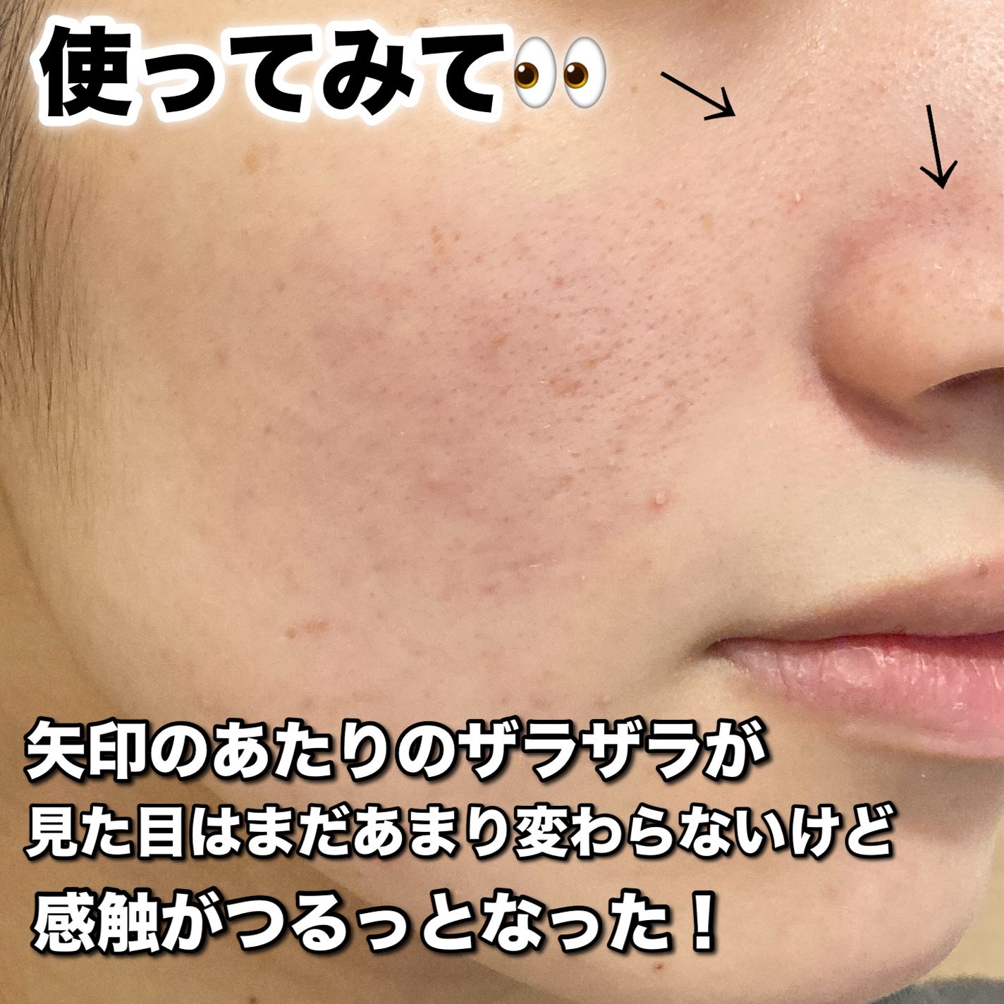 AHA 9.12 オミジャ 陶器肌 ウォッシュオフ セラム/parnell/美容液を使ったクチコミ(4枚目)