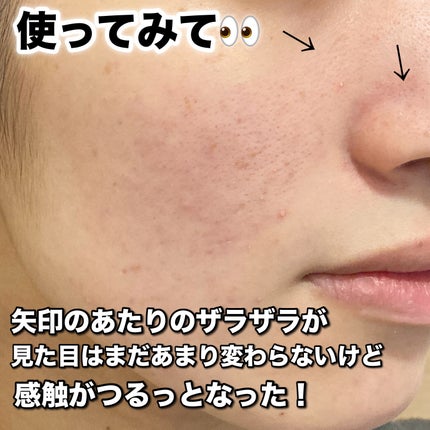 AHA 9.12 オミジャ 陶器肌 ウォッシュオフ セラム/parnell/美容液を使ったクチコミ(4枚目)