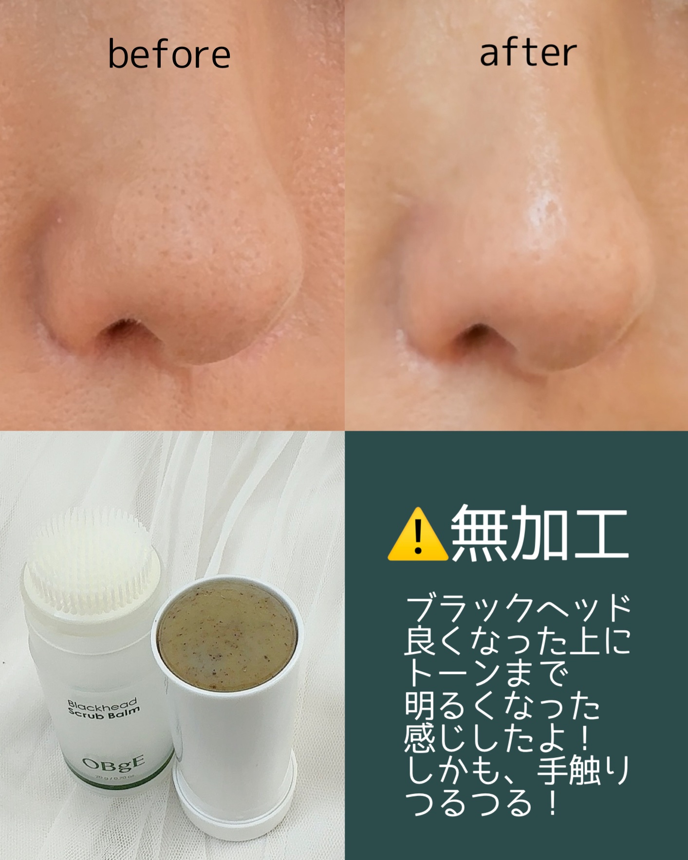 ブラックヘッドバームスクラブ/オブジェ/フェイスバームを使ったクチコミ（2枚目）