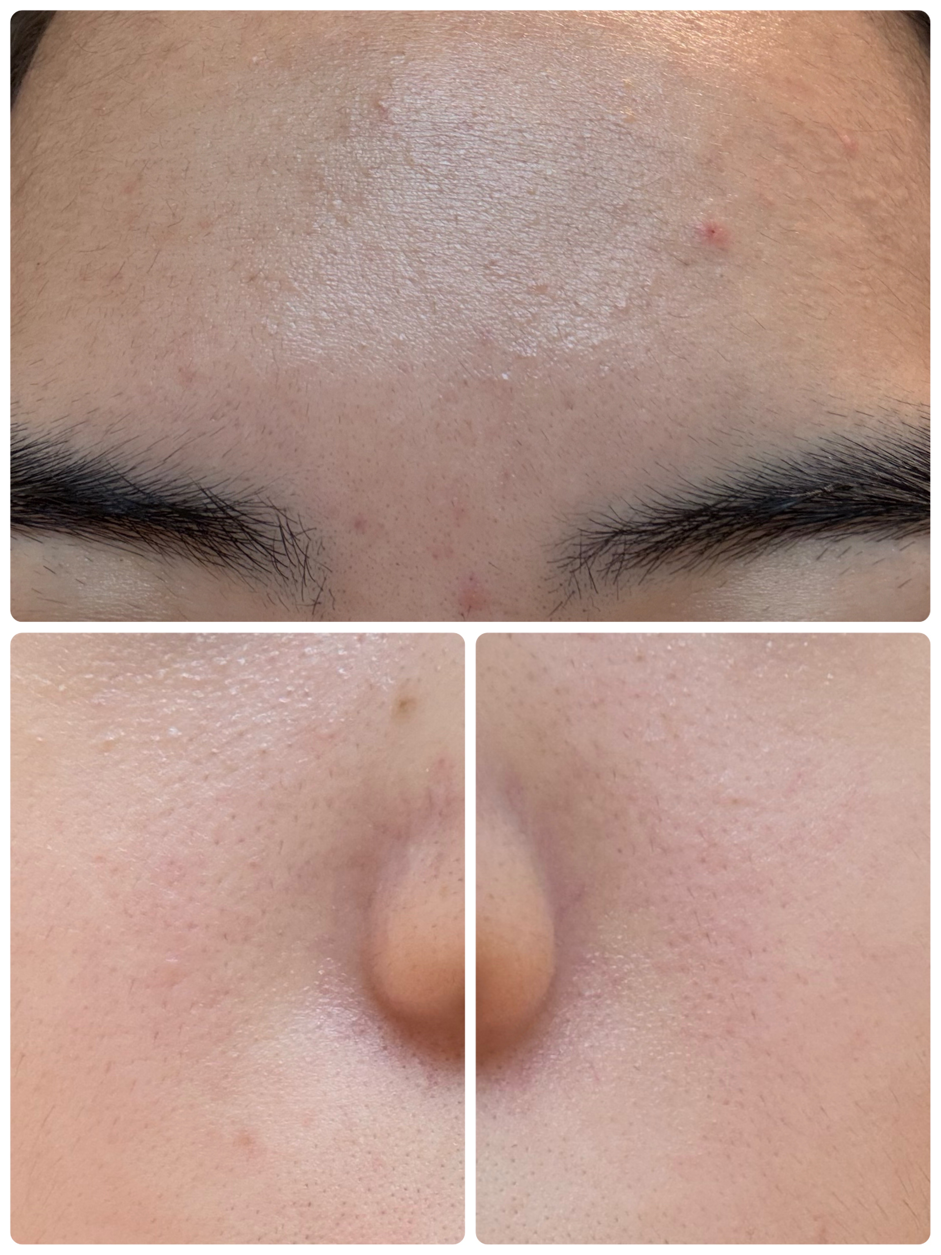 AGE-R ブースタープロ/MEDICUBE/美顔器・マッサージを使ったクチコミ（3枚目）