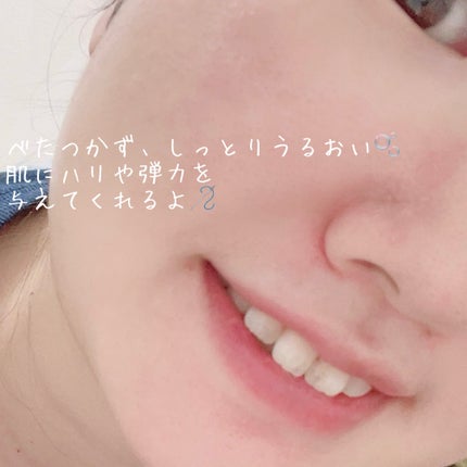 プロバイオダーム™ 3Dリフティング バイオトクシルPLGAセラム/BIOHEAL BOH/美容液を使ったクチコミ(3枚目)