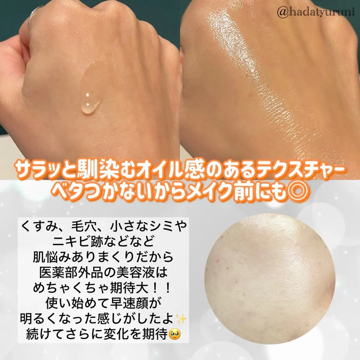 ミシャ ビタシープラス 美容液【日本処方】/MISSHA/美容液を使ったクチコミ（3枚目）