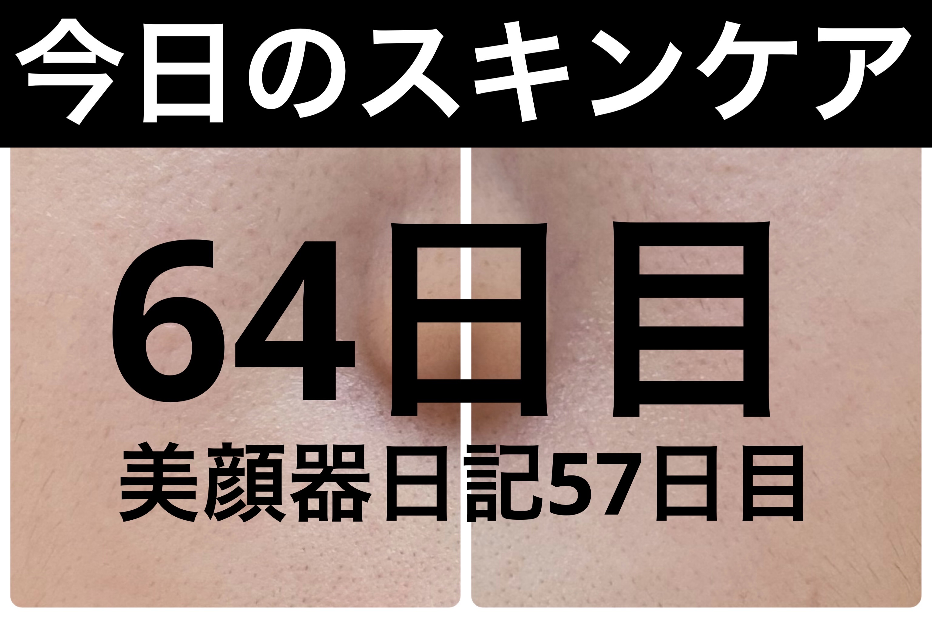 AGE-R ブースタープロ/MEDICUBE/美顔器・マッサージを使ったクチコミ（1枚目）