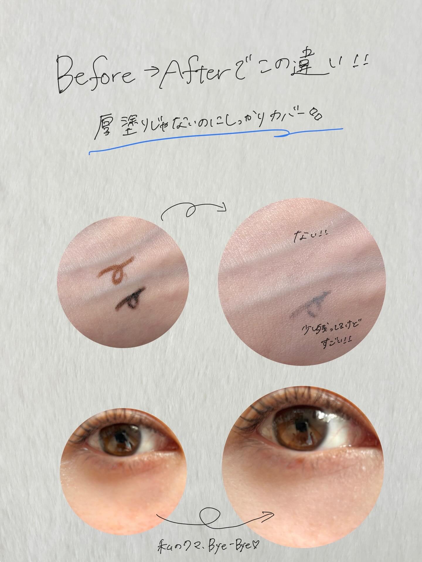 ダーマシンコンシーラー/23years old/リキッドコンシーラーを使ったクチコミ（3枚目）