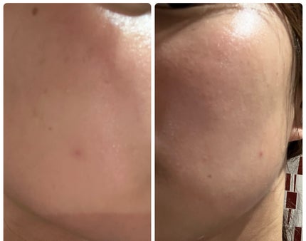 ぽむ on LIPS 「1枚目 2025.11.2エピデュオ 781日目2枚目 202..」(4枚目)