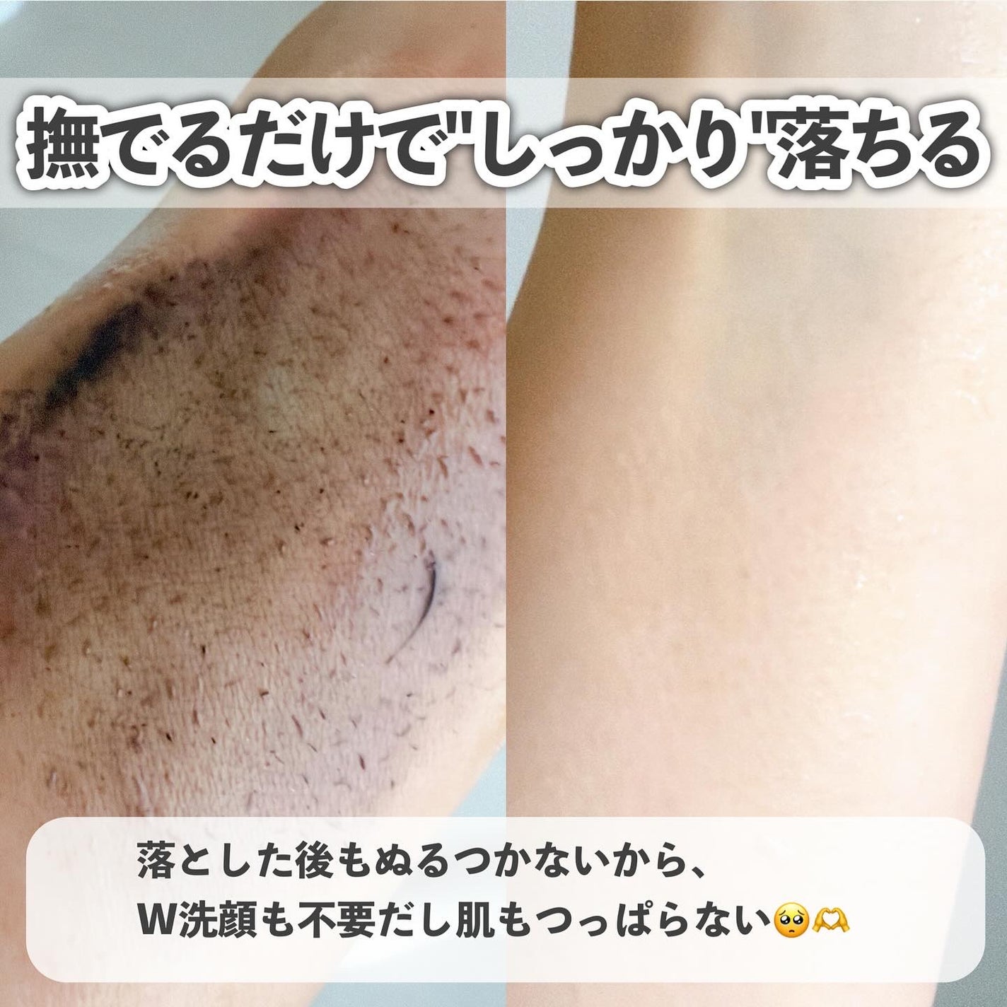 スクアレンリセットポアディープクレンジングオイル/B:lab/オイルクレンジングを使ったクチコミ(6枚目)