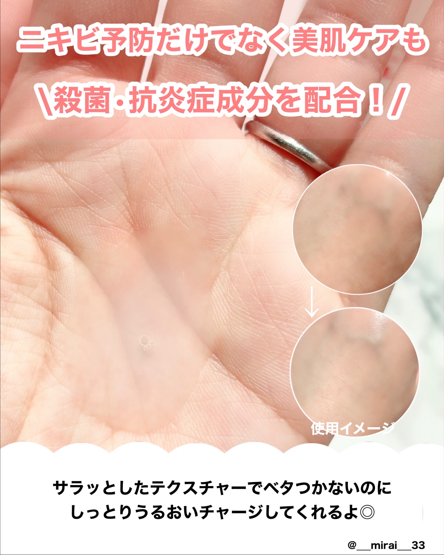 薬用化粧水/スキンライフ/化粧水を使ったクチコミ（2枚目）