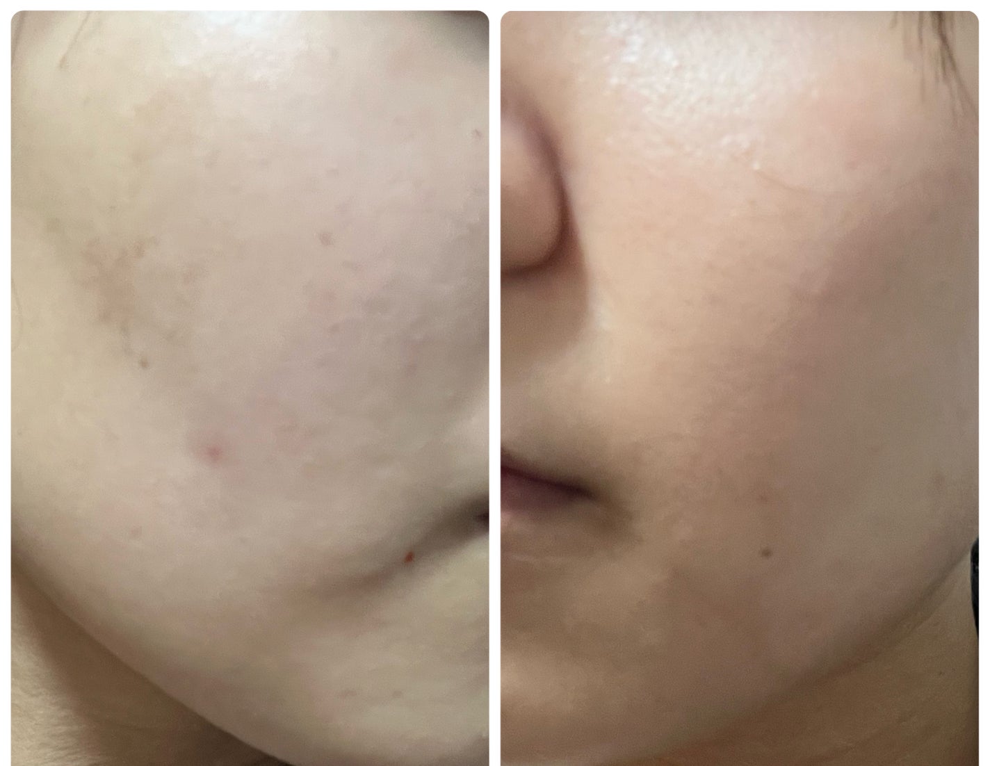 ぽむ on LIPS 「1枚目 2025.11.2エピデュオ 781日目2枚目 202..」(2枚目)