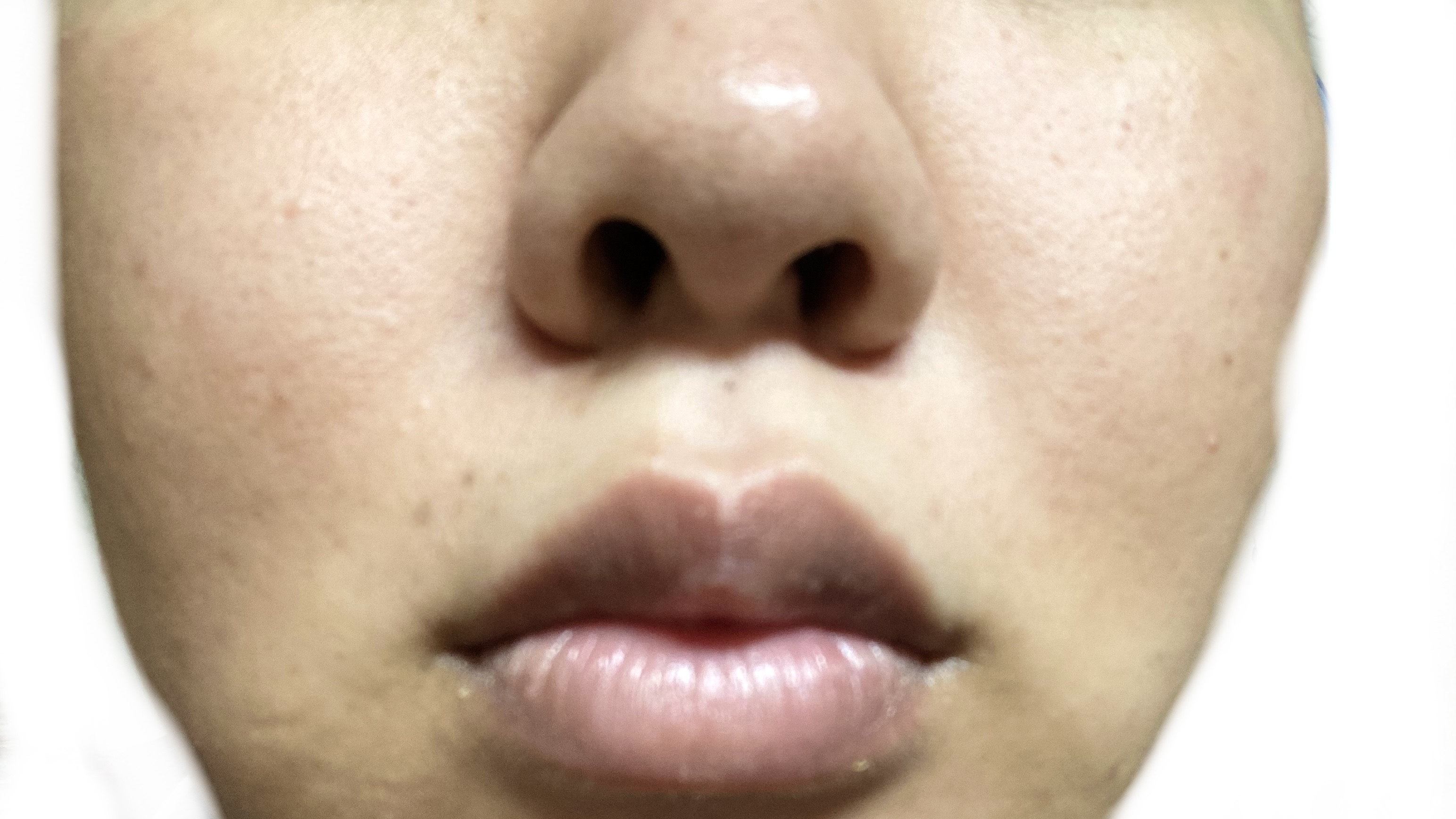 ちふれ 保湿乳液のクチコミ「✼••┈┈••✼••┈┈••✼••┈┈••✼••┈┈••✼

　前々から気になっていたリードル.....」（3枚目）